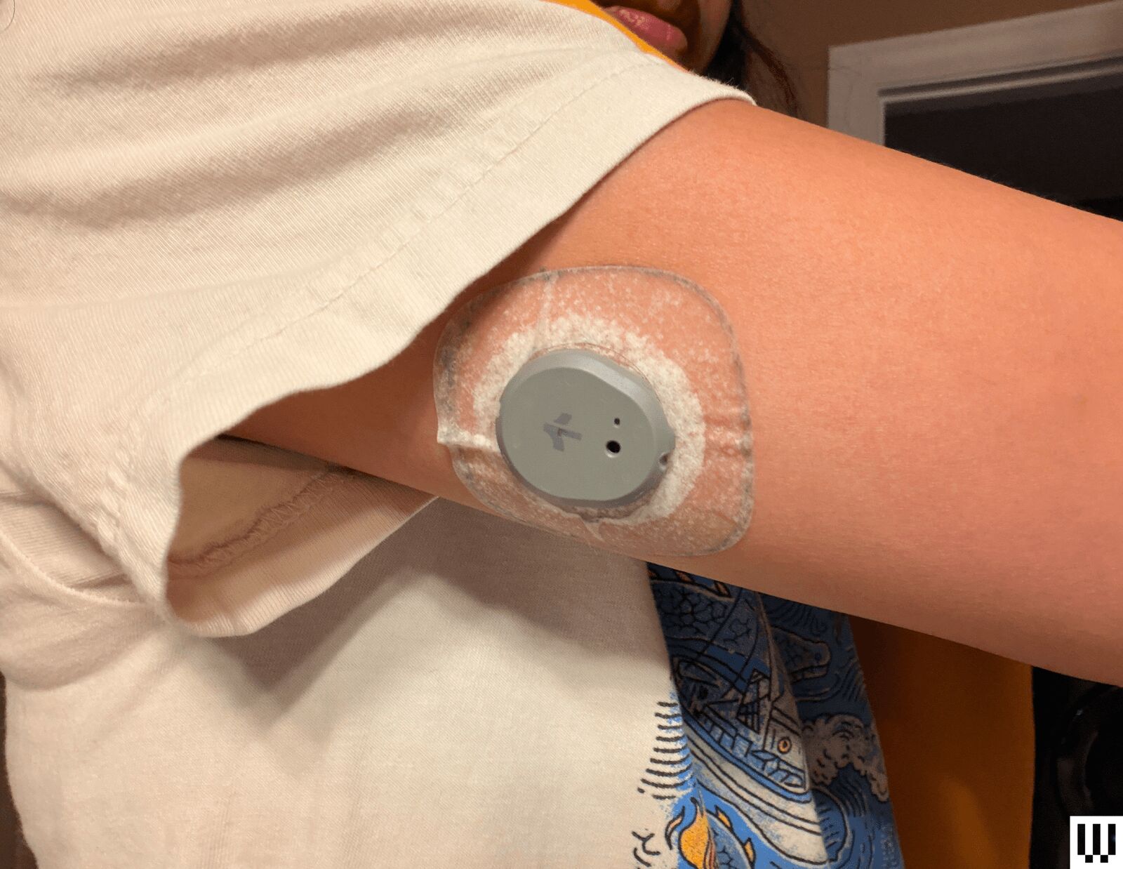 Monitor de glucosa